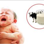 Vì sao trẻ bị dị ứng đạm sữa bò?